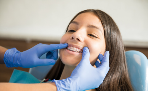 Ergenlik döneminde diş teli tedavisi