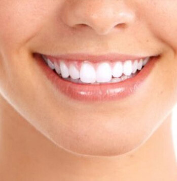Aesthetic Dental Treatments