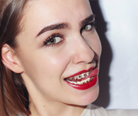 Ortodonti Tedavisinde Diş Lastikleri