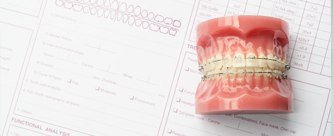 Ortonorm - Ortodonti Tedaviye Başlamak için Yapılması Gereken İşlemler